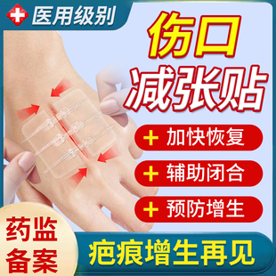 医用减张贴皮肤术后疤痕伤口免缝合专用减张器剖腹产甲状腺儿童YM
