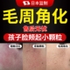 去除鸡皮肤疙瘩毛囊角化儿童脸上有小颗粒小孩长孩子毛周角化症YS