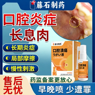 口腔炎症长息肉口腔肉芽肿肉瘤疙瘩舌下粘液腺囊肿溃疡唾液滤泡YY