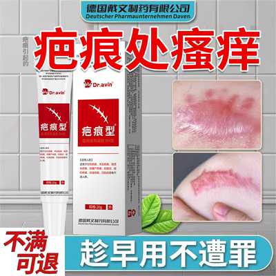 【现货速发】疤痕增生瘙痒
