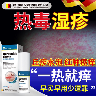 【现货速发】热毒湿疹止痒喷雾