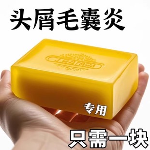 二硫化硒皂洗硒洗剂毛囊止痒去头屑官方旗舰店 香港中西大药房