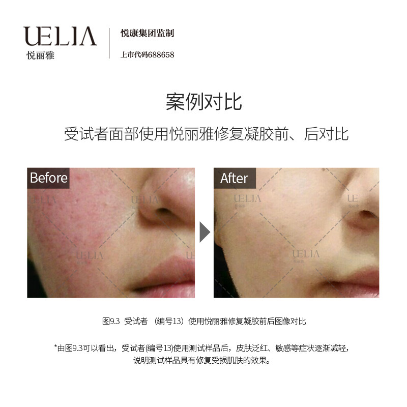 【官方发货 院线同款】悦丽雅透明质酸钠修复凝胶 a_