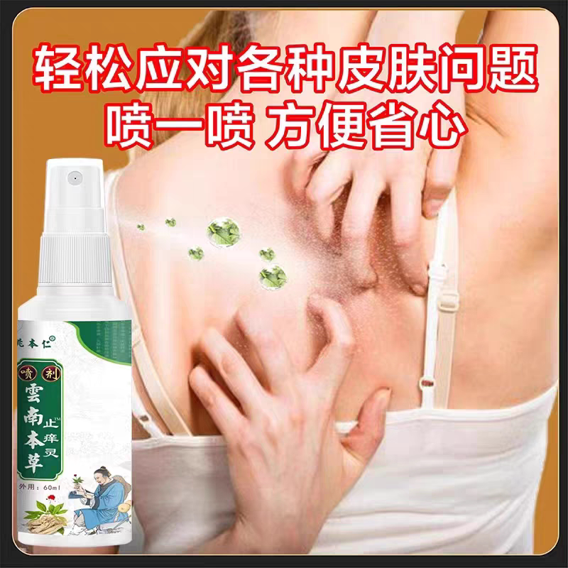 云南百草止痒灵喷雾蚊虫叮咬皮肤过敏红痒私处瘙痒快速止痒喷雾剂