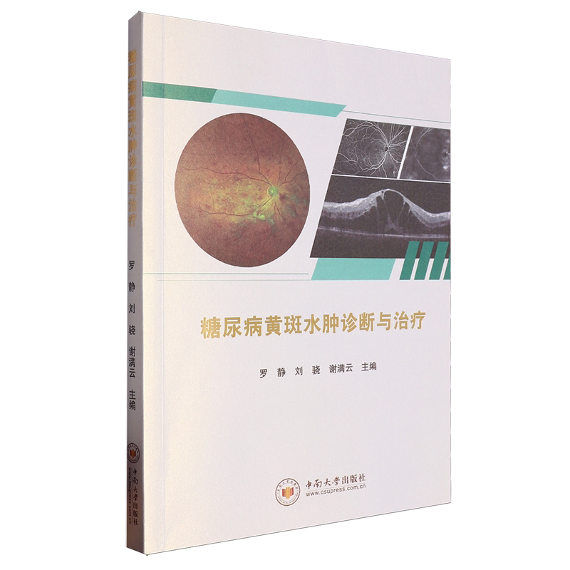 糖尿病黄斑水肿诊断与治疗