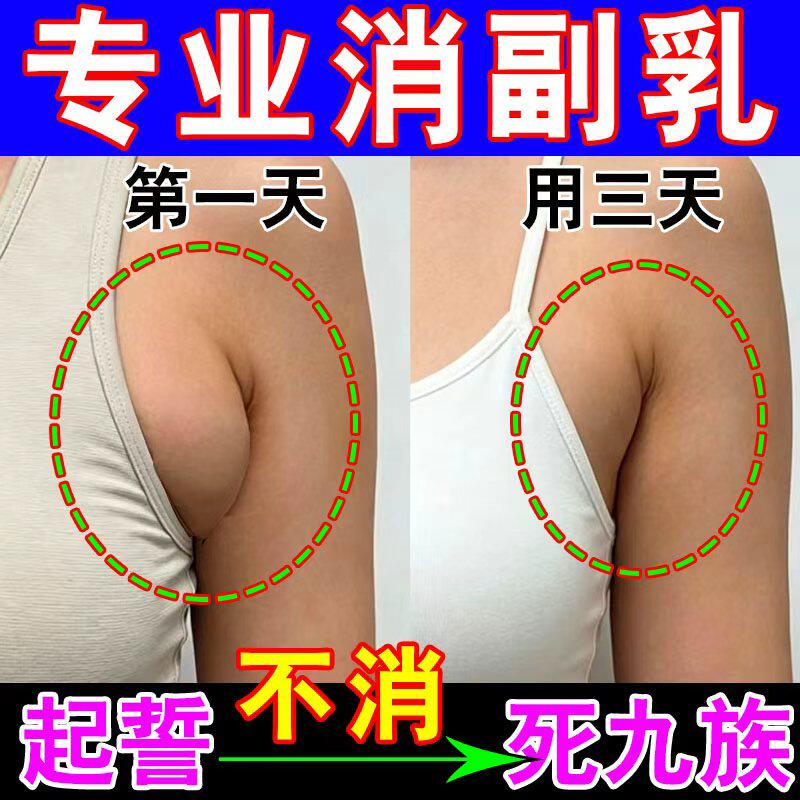 消副乳缩胸神器副乳消除膏腋下疏通副乳消淋巴肿大散结赘肉疏通贴
