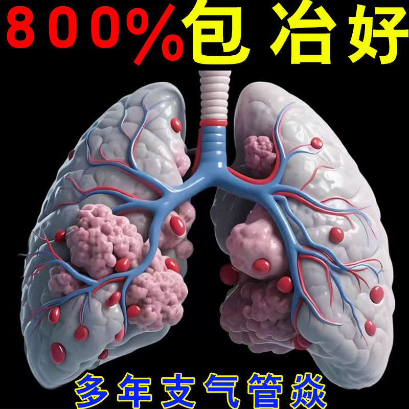 支气管炎老年急慢性支气管炎咳嗽止咳快化痰用清肺化痰哮喘贴