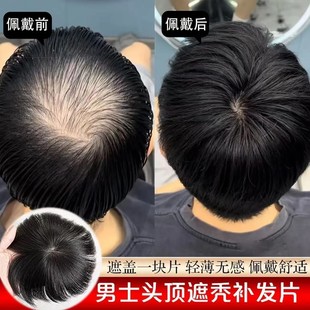 假发片男防真人发头旋发缝男士补发遮盖伤疤头顶部稀少脱发补发片