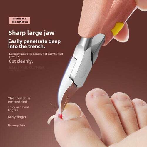foot hand dedicated ingrown toenail in embedded a pedicure