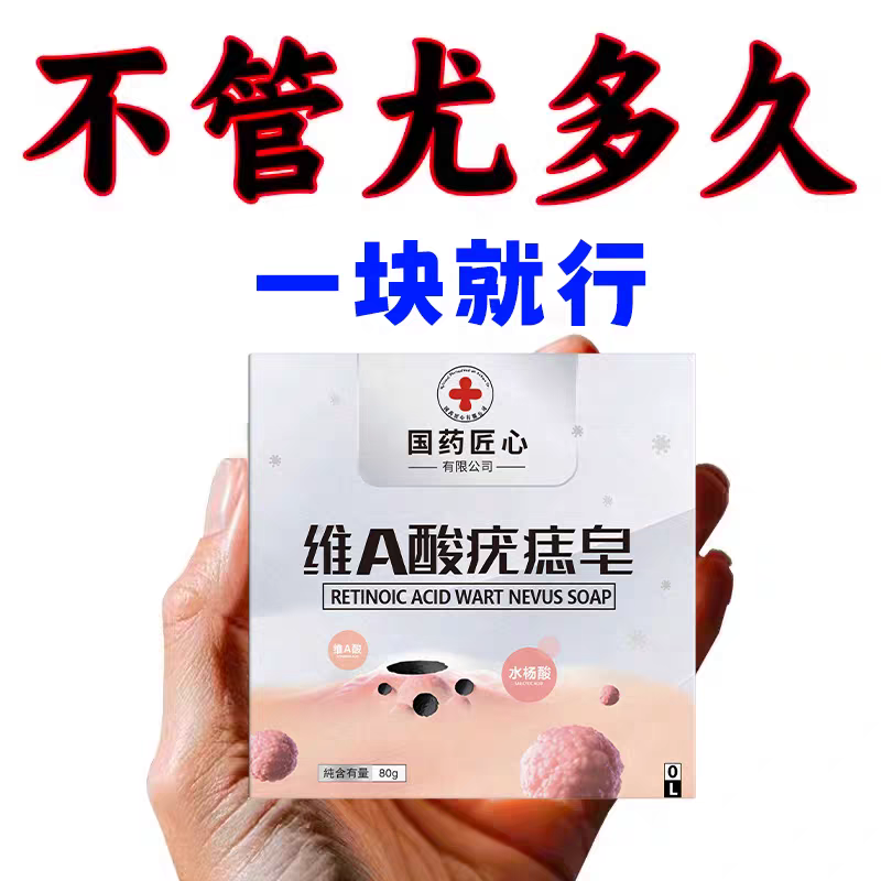 【早用早舒服】高效祛疣瘊药皂
