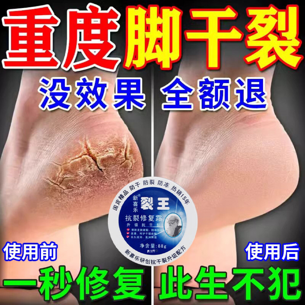 【秋冬防裂】手脚干燥开裂滋润膏