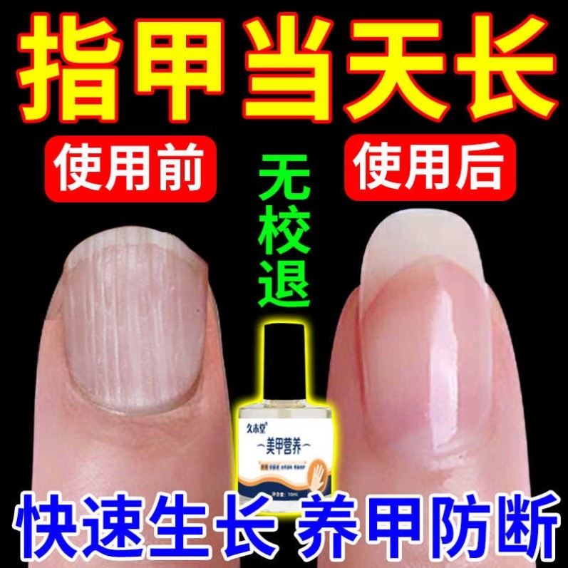 指甲快速生长液甲床受损分离啃咬变硬增厚空护甲坏甲修复油营养液