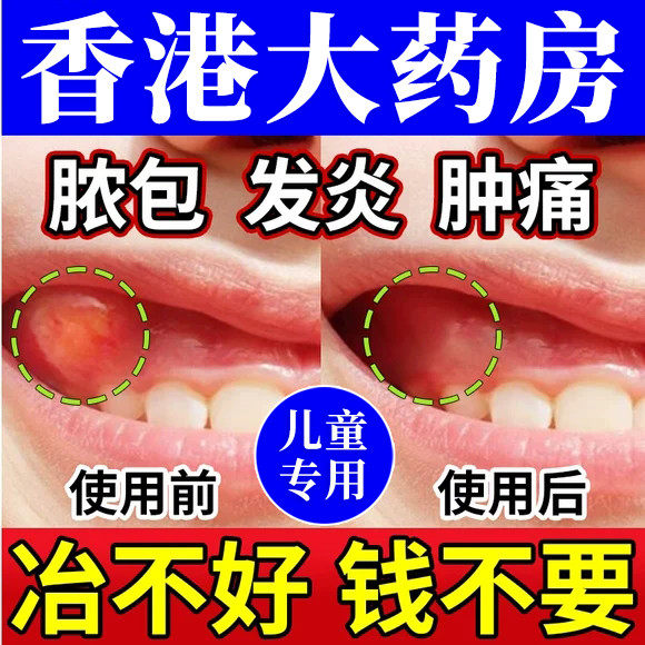 儿童小孩子小儿宝宝牙疼神器牙痛止疼药速效牙龈肿痛脓包发炎喷雾