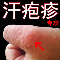 买2送1苗药手上长水泡膏手痒皮肤痒抑菌杀菌乳膏脚气止痒脱皮