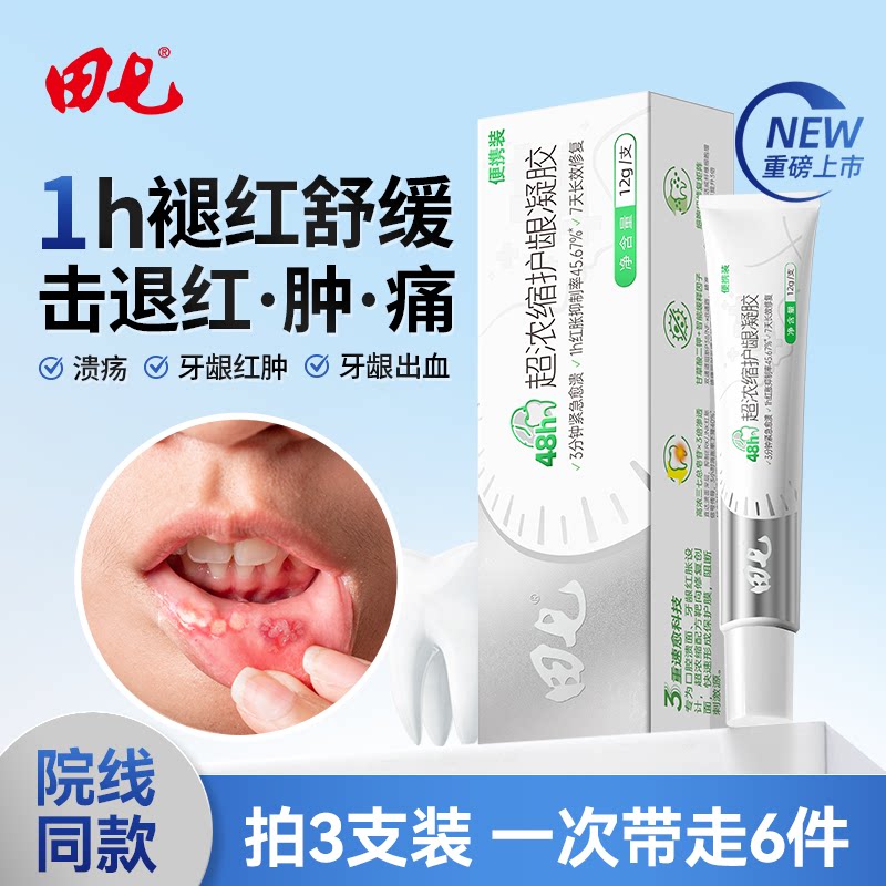 新品上市】田七护龈凝胶老品牌成人儿童温和护龈口腔修复凝胶正品