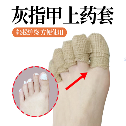 灰指甲上药保护套手指脚趾