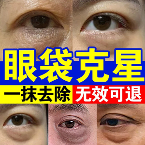 眼霜眼袋去除神器男士女专用贴精华油抗皱细纹淡化提拉紧致抗衰老