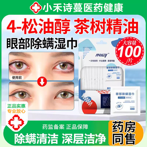 眼部除螨湿巾清洁专用4松油醇茶树油眼贴非医用缓解眼疲劳旗舰店