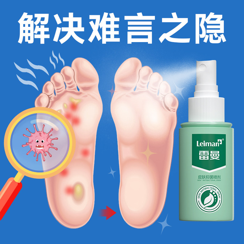 雷曼脚部喷雾去脱皮烂脚Y臭气痒汗水泡真菌抑菌液喷剂旗舰店正品