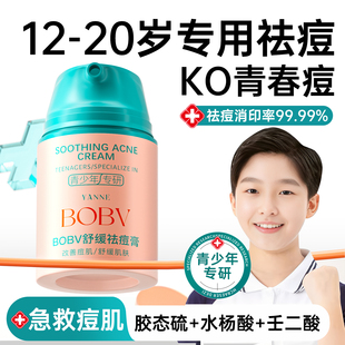 青少年去痘膏祛痘正品 青春痘初中生去粉刺闭口祛痘印男女学生