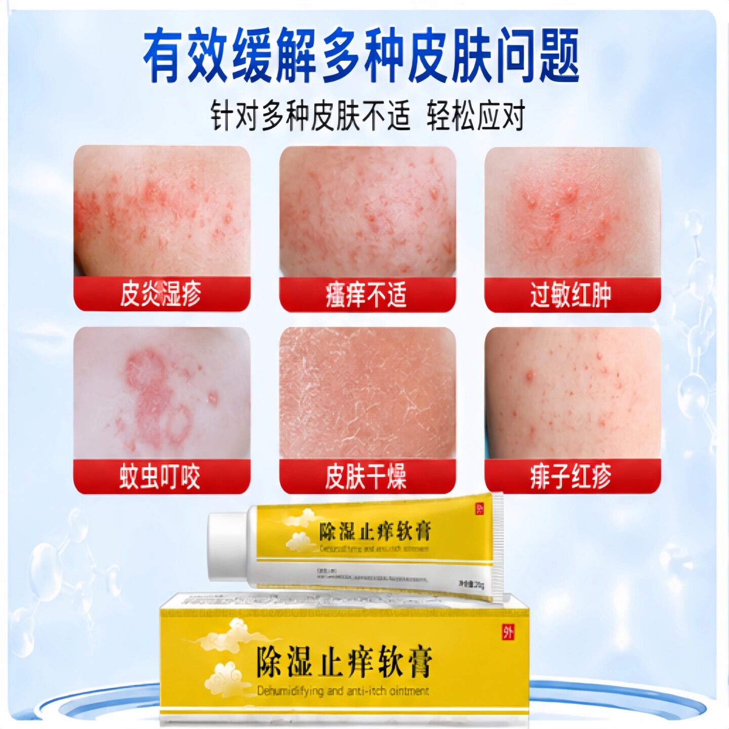 除湿止痒软膏官方正品店
