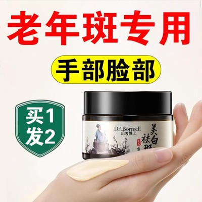 手上老年斑强力去除专用男士去斑