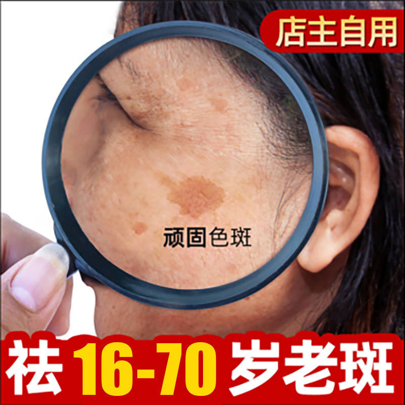 脸部祛黑色素沉淀祛除脸上黑斑祛色素斑暗沉淡化痘印疤印美白淡斑