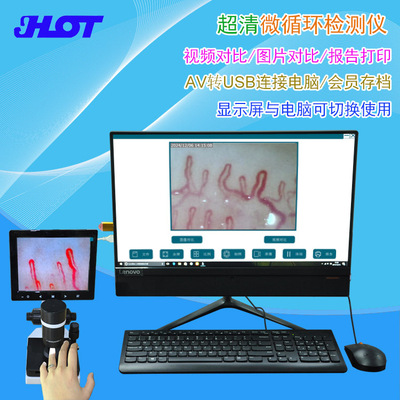 跨境 高清甲壁微循环检测仪 末梢血管检测仪拍照录像存档报告打印