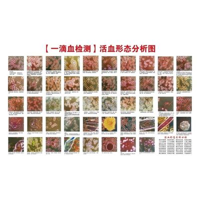 人本血液检测血样活血形态分析图墙上挂图海报印制展板墙贴纸