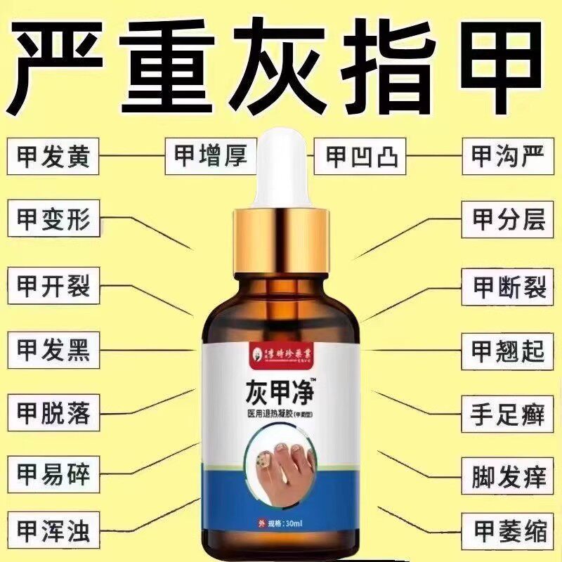 李时珍灰甲净无痛去灰指