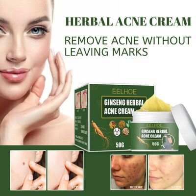 EELHOE人参草本净痘膏清洁亮肤