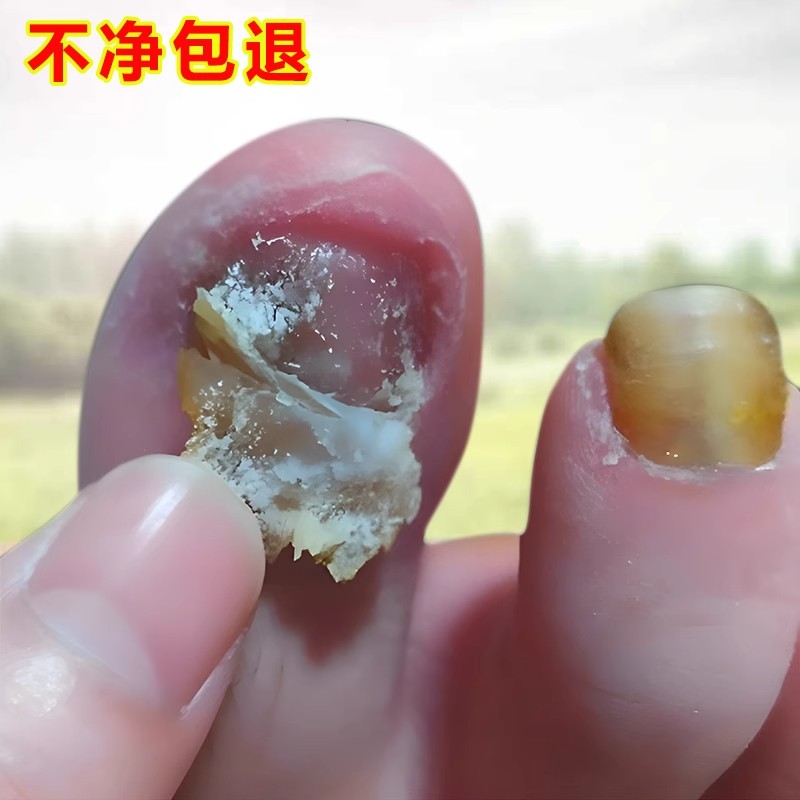 【断货王】去灰抑菌不脱钾