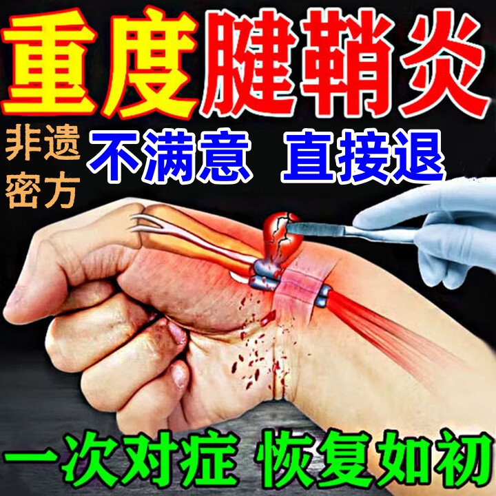 治疗腱鞘炎特效大拇指药疼痛贴膏健鞘手指关节键销肌腱专用