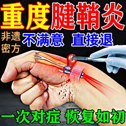 治疗腱鞘炎特效大拇指药疼痛贴膏健鞘手指关节键销肌腱专用