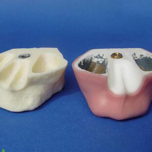 颐诺口腔牙科种植l练习实训操作上颌骨带上颌窦提升练习模型