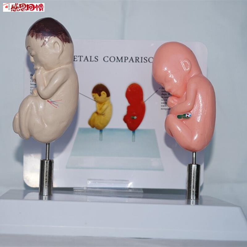 吸烟胎儿K与正常胎儿比较模型 人体 医用教学健康保健讲解展