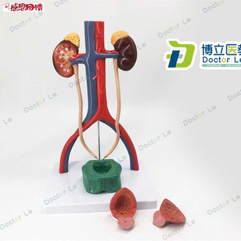 人体泌尿系统T模型肾输尿管膀胱尿道解剖模型医学泌尿科 泌尿模