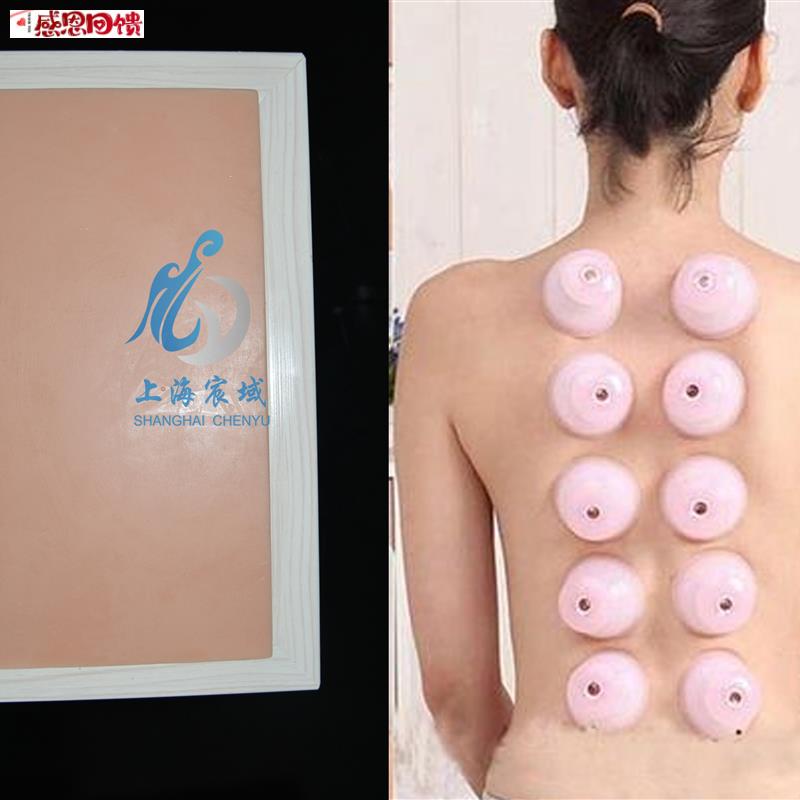 医用拔火罐手法训练模
