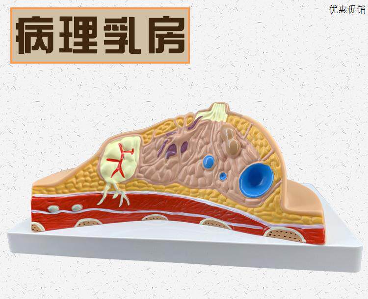 乳房模型胸部解剖模型静止期哺乳期女性病变乳腺p结构乳房医学教