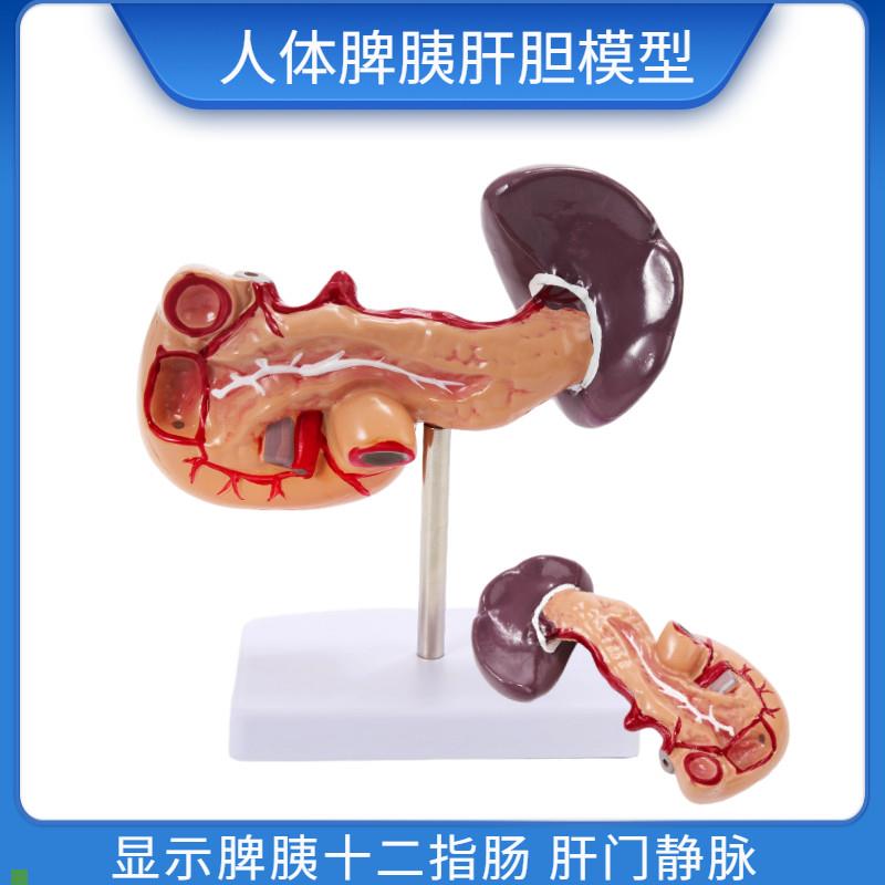 教学仿真人体胰脾肝胆十二v指肠模型1:1自然大普通胰腺内脏标本