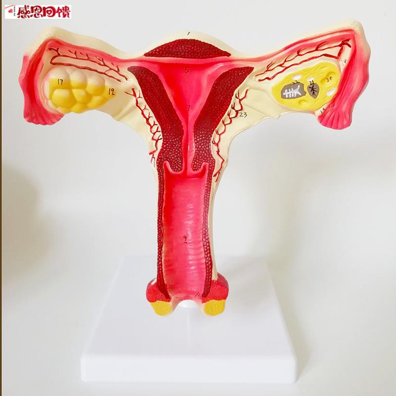 女性生殖器子宫t模型阴道卵巢教学模具病理变化产科普厂