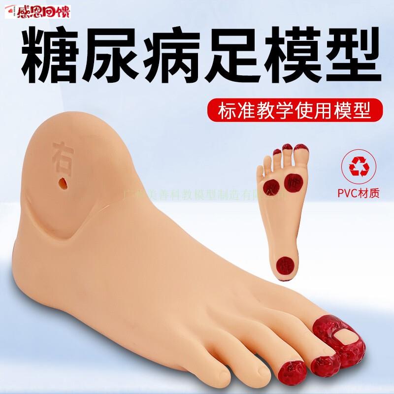 糖尿bing足护理模型 老年人 足部病Y变护理模型 畸形脚模