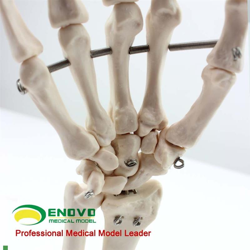 ENOVO颐诺医学人体q手关节模型手骨尺骨桡骨模型人体骨骼手足外科