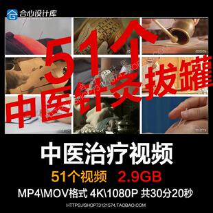 中医医生把脉经脉温灸艾灸针灸拔罐火罐健康实拍视频素材