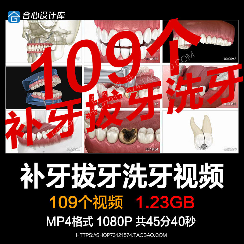 口腔卫生镶假牙拔种植牙齿3D模设计素材/源文件