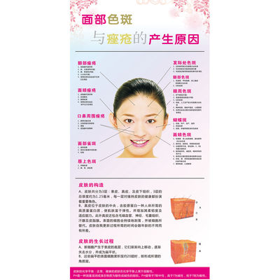面部色斑和痤疮的产生原因分析海报宣传画广告贴图片挂画图