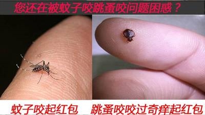 儿童被蚊子咬的药 涂蚊子包叮的包消去蚊子咬的包 宝宝擦蚊子咬j