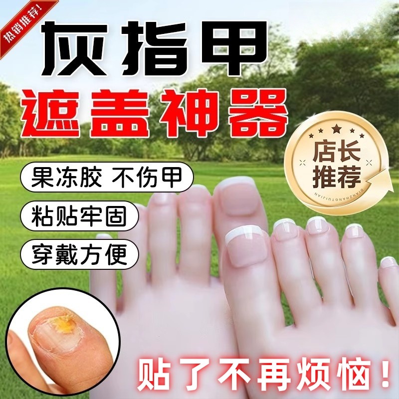灰甲遮丑贴脚趾手足夏季遮盖灰甲贴防水防汗牢固凉鞋露脚指甲片贴