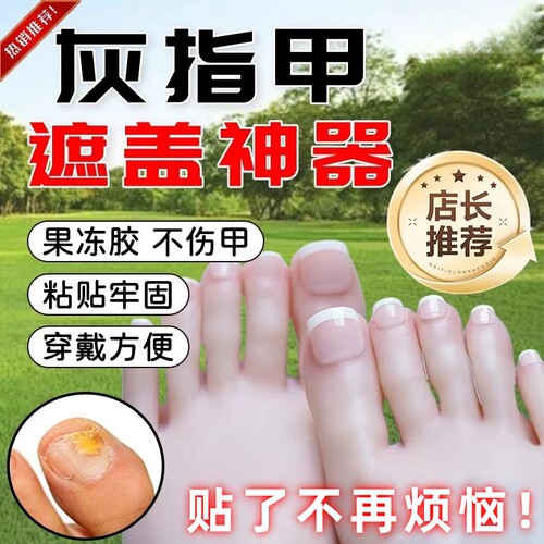 灰指甲遮丑贴脚趾手足遮盖灰甲贴