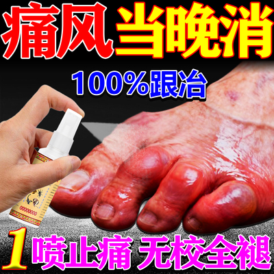 痛风降i尿酸溶石去结晶专用